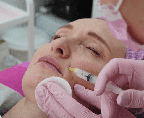 Botox and fillers at Looks Clinic