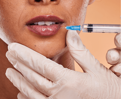 Botox and fillers at Looks Clinic