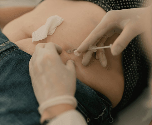 Tummy tuck consultation at Looks Clinic